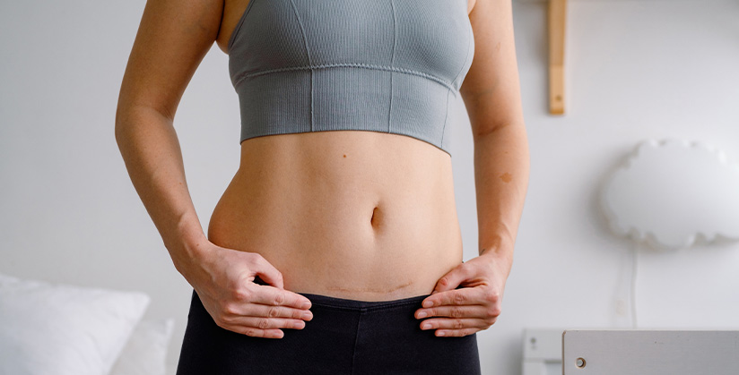 Adhérence cicatrice kiné : comment traiter les cicatrices par la kinésithérapie