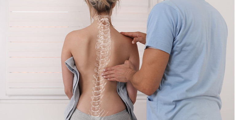 Prendre en charge un patient atteint de scoliose en kiné